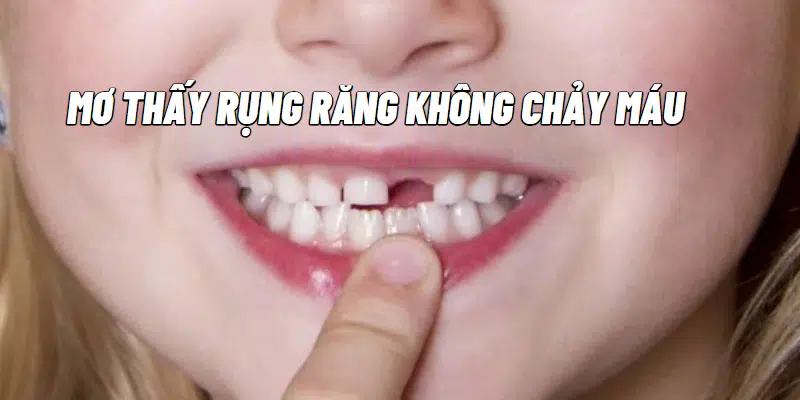 Mơ thấy rụng răng không chảy máu